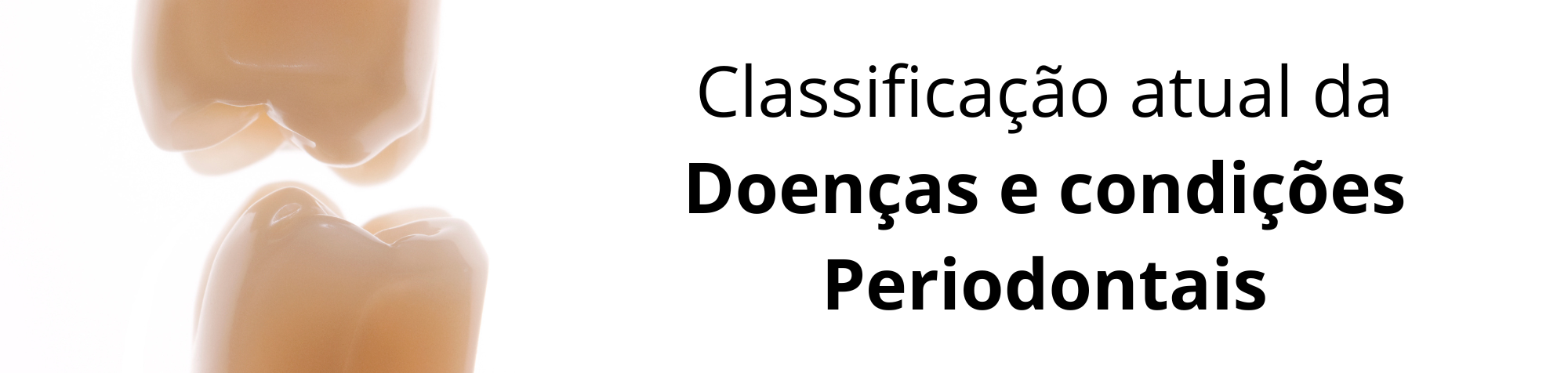 Classificação atual da Doenças e condições Periodontais
